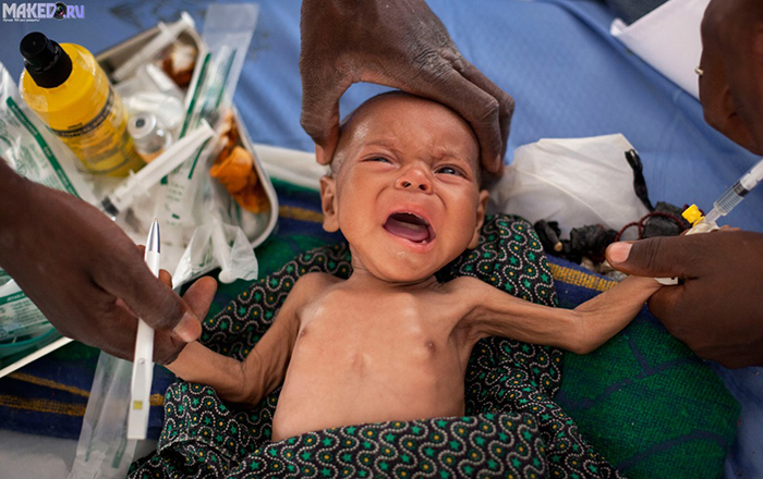 Gần 1 triệu thiếu nhi Việt Nam đang đói vi chất