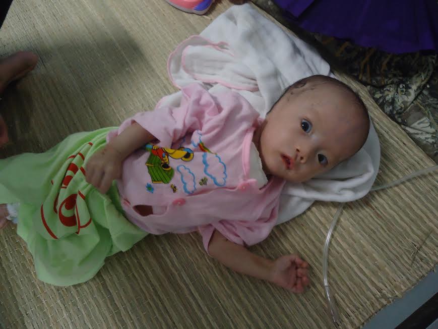 Thương bé gái 3 tháng tuổi đối diện nhiều ca phẫu thuật