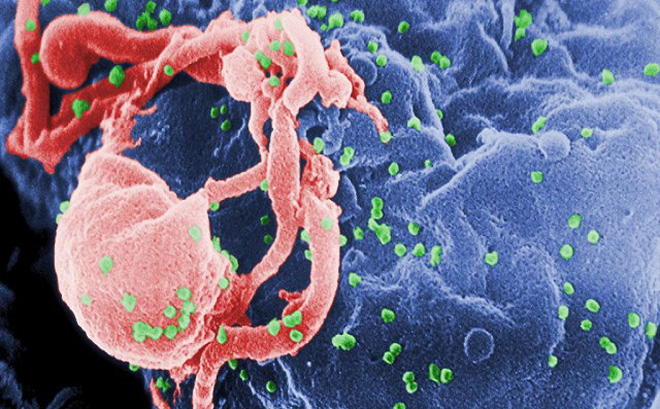 Hi vọng mới trong điều trị bệnh nhân nhiễm HIV