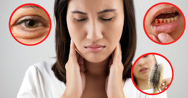 5 dấu hiệu thiếu vitamin triệu chứng rõ trên khuôn mặt